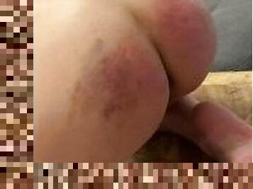 the day after the spanking, another hard spanking on the sore butt