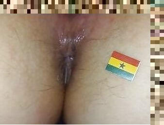 Ghana Accra anus